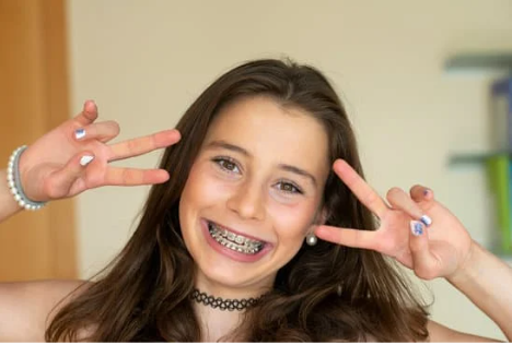 Things To Consider Before Getting Orthodontic Treatment